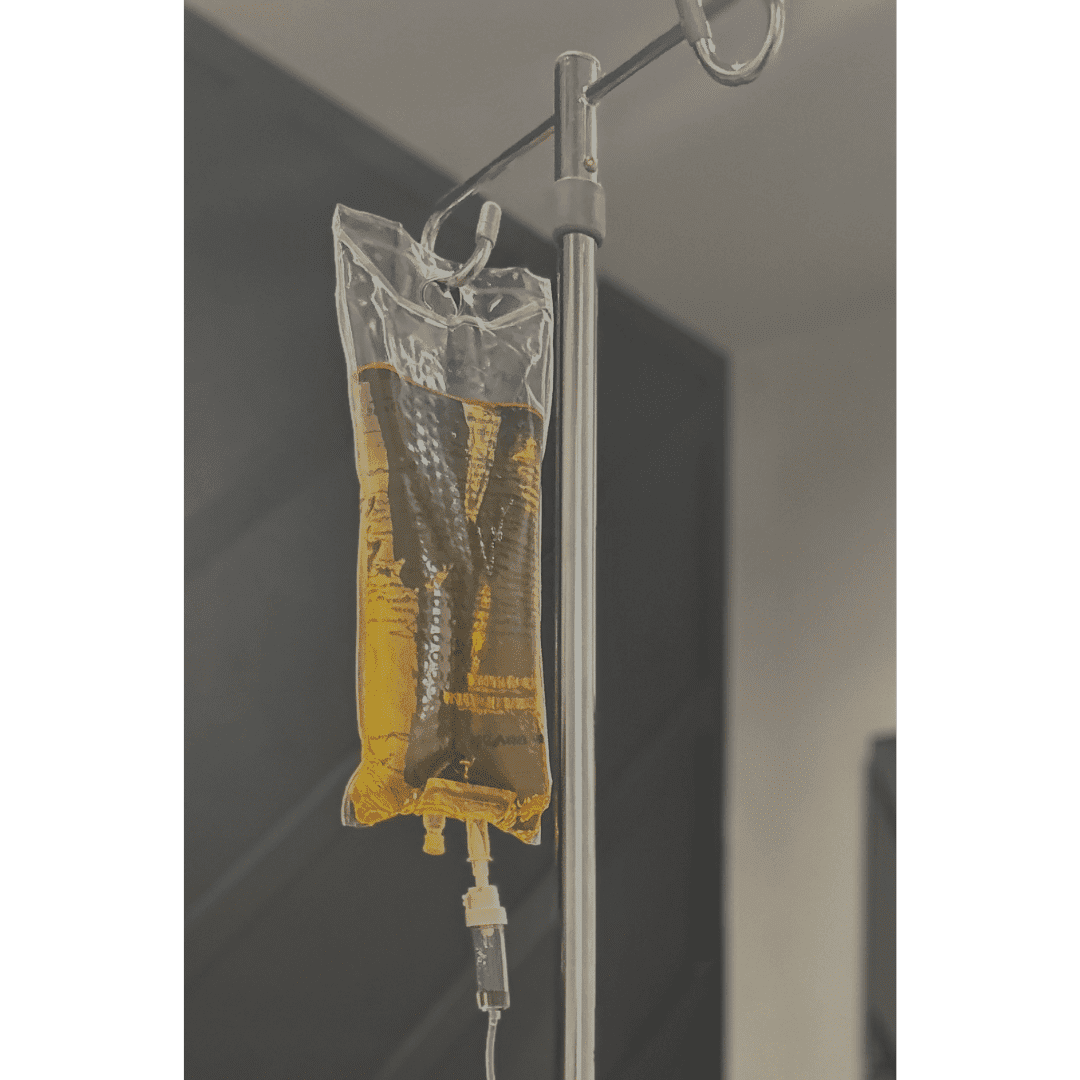IV bag filled with yellow fluid hanging on a metallic stand.